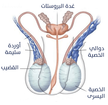 في الخصيتين الدوالي دوالي الخصية